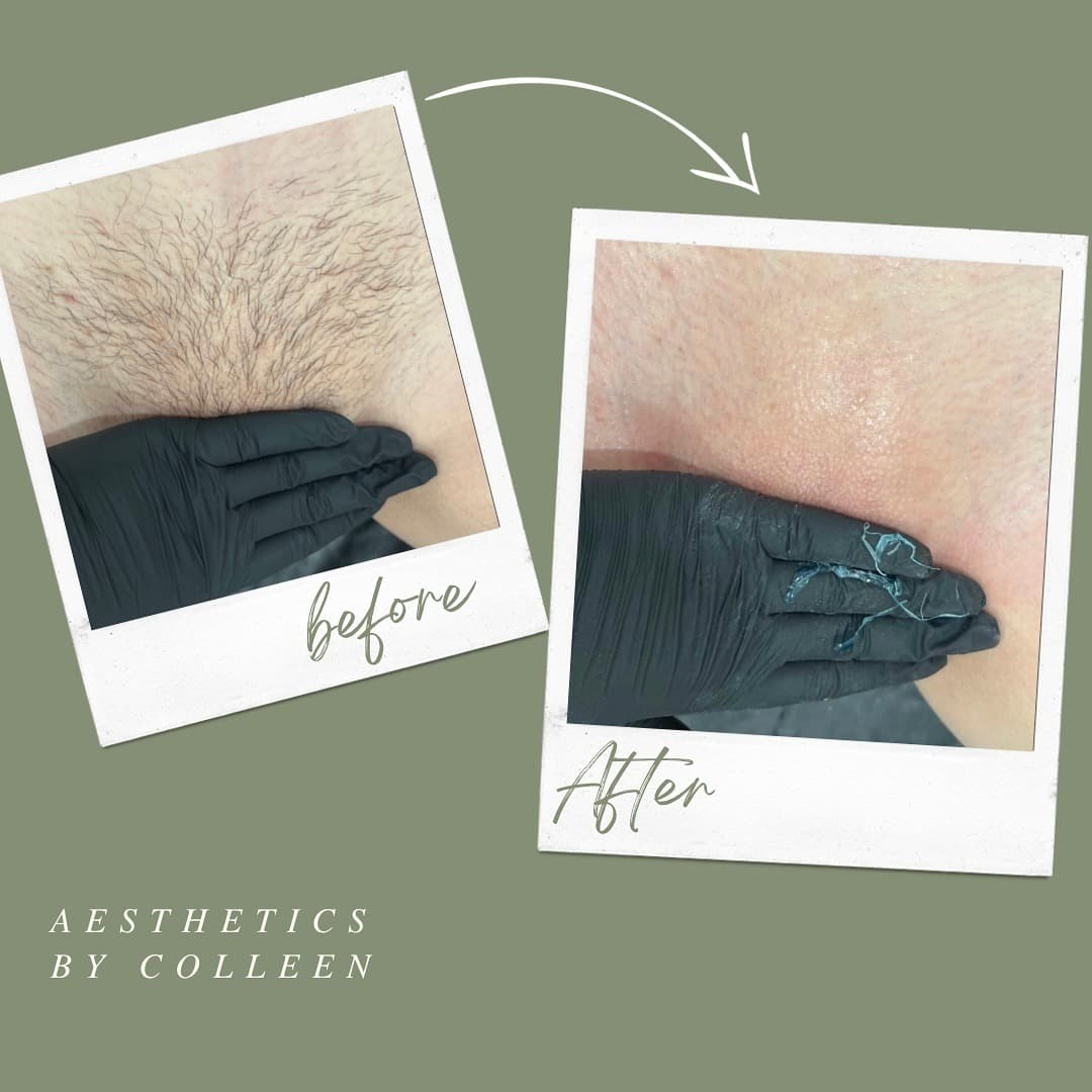 Brazilian & Bikini Waxing gallery 9