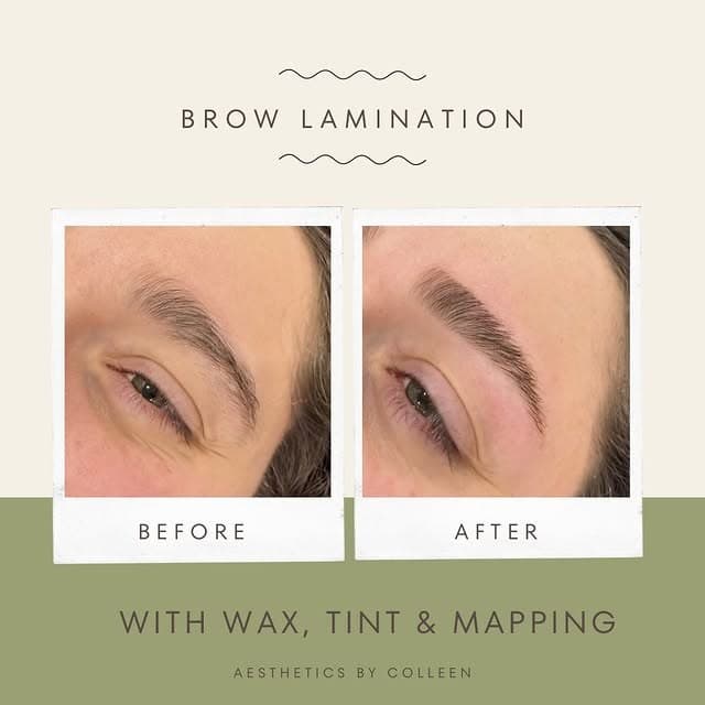 Brazilian & Bikini Waxing gallery 1
